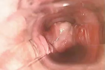 Blogger đụ em gái còn trinh - Hidden đụt nhau cam.